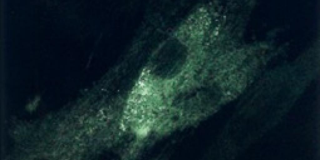 Amiloide
